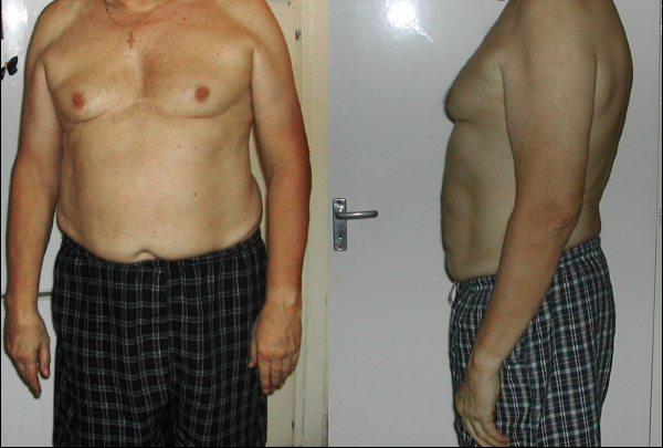 Nagy fogyás: 9 férfi, aki 20 kilónál többet fogyott – előtte-utána fotók